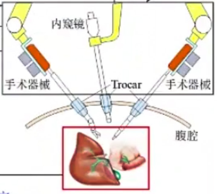 腹腔鏡手術(shù)機(jī)器人結(jié)構(gòu)設(shè)計原理—AIP艾普 腹腔鏡手術(shù)機(jī)器人結(jié)構(gòu)設(shè)計原理—AIP艾普